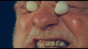 A close-up of a person's face with pickled onions, smiling broadly, revealing teeth.